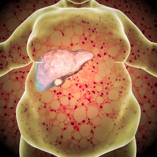 Médicaments anti obésité, illustration Shutterstock.